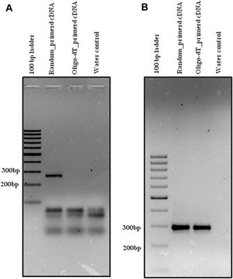 Cost-Effective Transcriptome-Wide Profiling of Circular RNAs by the Improved-tdMDA-NGS Method